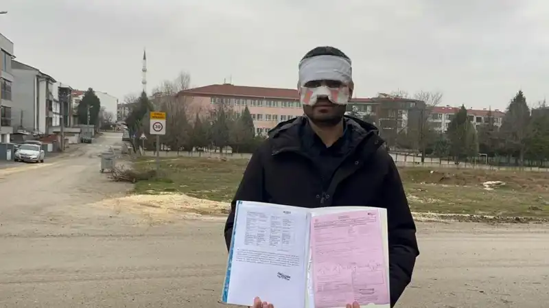 Öğretmen Öğretmeni Yakıp Yüzüne Sıcak Çay Fırlattı! Olayın Sırrı Ne?